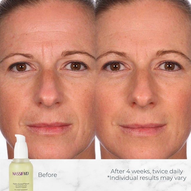 NassifMD Hydro-Screen Hydration Serum | Surgeon-Created Hyaluronic Acid Ceram... gallery