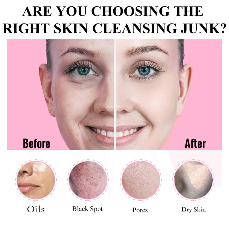 Clay Mask Set 20 Pods, Face Mask Skin Care, Green Tea, Turmeric, Dead Sea Mud... gallery